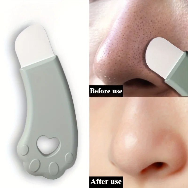 Luxury Skincare Acne - Herramienta para Eliminar Puntos Negros con