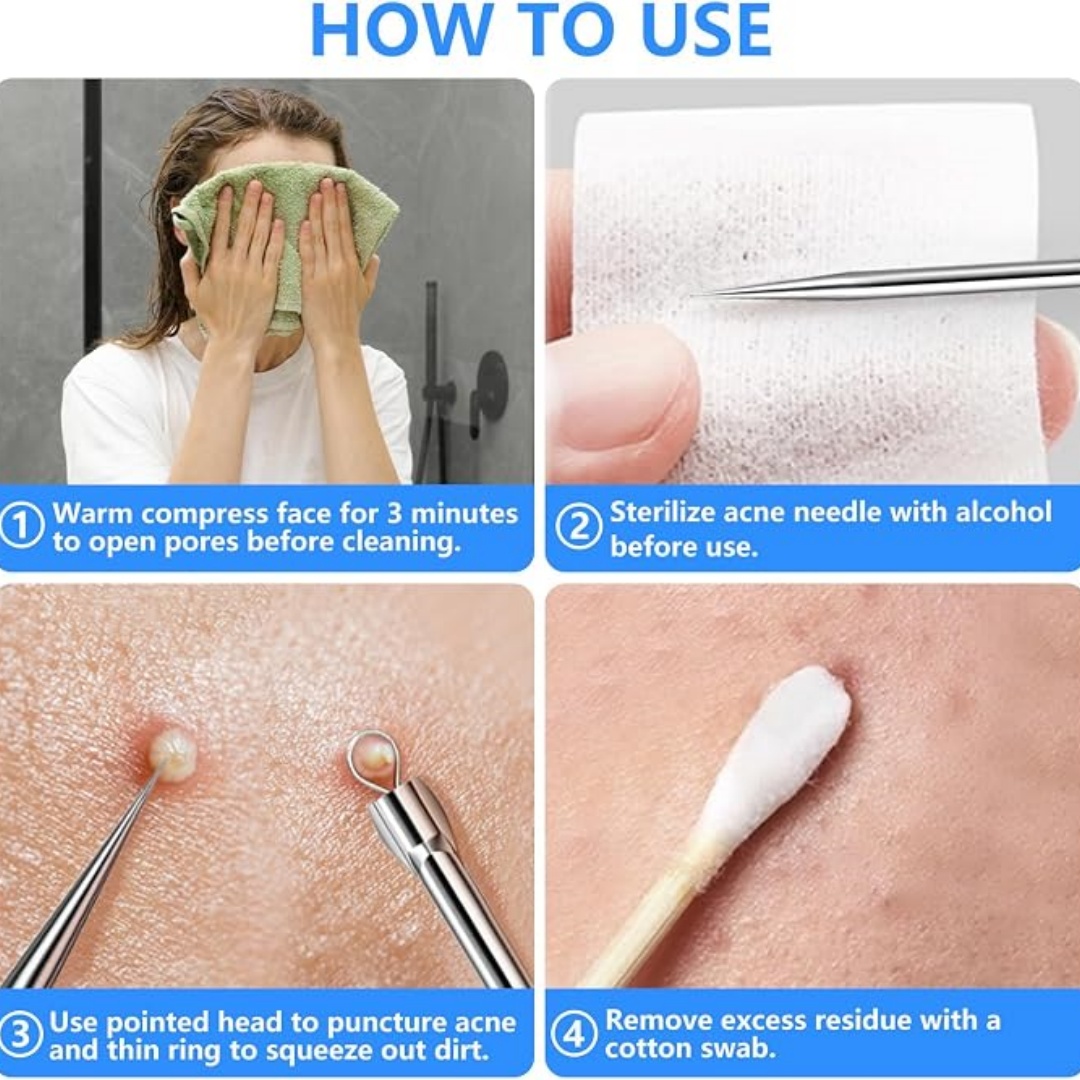 Kit de 5 piezas para eliminar  - Luxury Skincare Acne reseña y precio